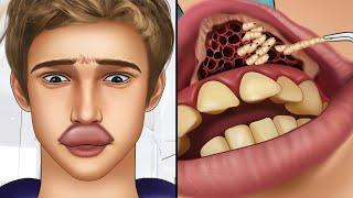 ASMR Remove botfly maggots found inside mountaineer's mouth | Dental care animation