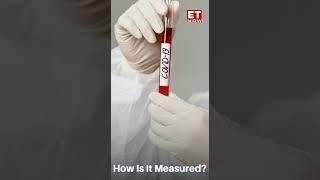 What Is 'CT Value' In An RT-PCR Test For Covid-19 & Why Is It Important? Watch