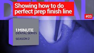 Showing how to do perfect finish line. 1 dental minute