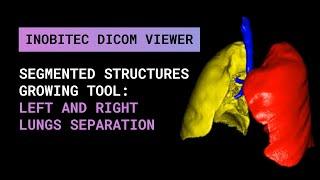 Segmented structures growing tool: left and right lungs separation