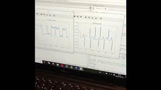 Piezoelectric sensor signal filtering