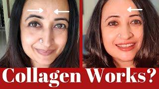 Collagen supplement 3 month review. Does it really make skin healthy & glowing? Inja Marine Collagen