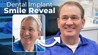 INCREDIBLE Smile Transformation – Bill’s Dental Implant Journey