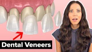 Dental Veneers Procedure Explained