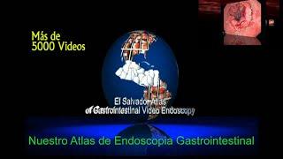 Nuestro Atlas de Endoscopia en Línea cumple 20 años