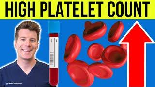 Doctor explains HIGH PLATELET COUNT (Thrombocytosis) | Causes, symptoms and more