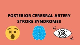 Posterior Cerebral Artery Stroke Syndromes | Anatomy | Clinical Features |