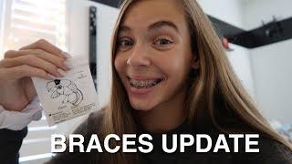 BRACES UPDATE!