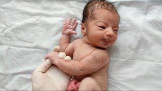 Gorgeous Newborn baby Girl full of HAIR  just after birth is Cutest #cute #birth #love