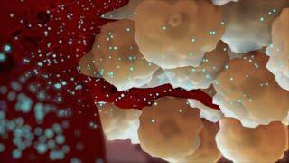 Type 2 Diabetes | Nucleus Health