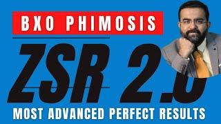 BXO Phimosis | ZSR 2.0 GREEN Circumcision Surgery | Stitch less Advanced | Perfect Surgical Results