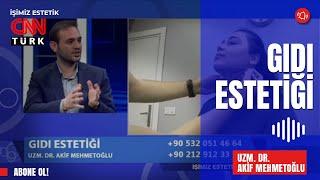 Gıdı Estetiği - Uzm. Dr. Akif Mehmetoğlu - CNN Tür
