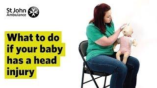 What to do if your Baby has a Head Injury - First Aid Training - St John Ambulance