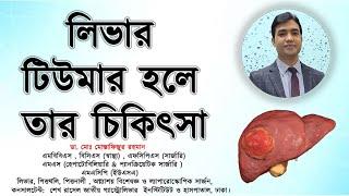 লিভারে টিউমার হলে তার চিকিৎসা | Treatment of liver tumors | Dr. Mustafizur Rahman