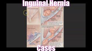 Inguinal Hernia Cases