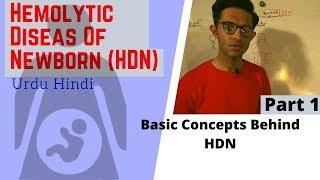 Hemolytic Disease of Newborn (HDN) || Pathophysiology || Part 1