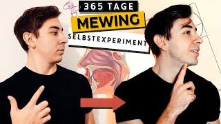 365 Tage Mewing - Durch Zungenposition ein attraktives Gesicht bekommen (Mewing deutsch)