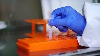 2019-nCoV Antigen Test (Lateral Flow Method)