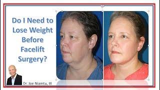 Do I need to Lose Weight Before Facelift Surgery?