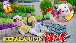 Kepala Upin Bocor Saat Balapan Sepeda