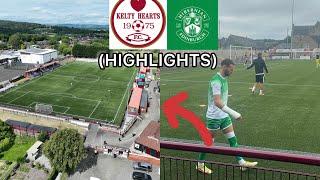 KELTY HEARTS V HIBS SCOTTISH LEAGUE CUP (HIGHLIGHTS) !!!