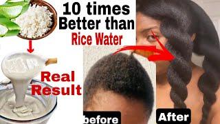 NO JOKE!Overnight Hair Growth Treatment! Better than Rice Water |How I grew my hair Thicker n Longer