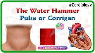 The water hammer pulse or Corrigan (hyperkinetic) pulse || #usmle cardiology