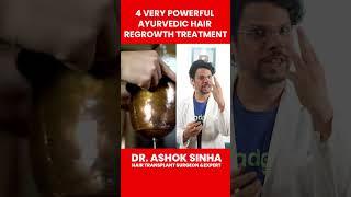 4 Ayurvedic Treatment For Hair Loss & Hair Regrowth | Hair Damage | Hair Fall | Hair Growth | Adon |