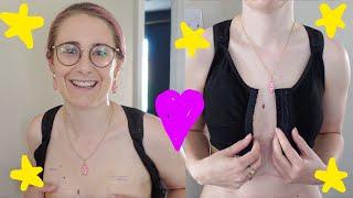 seeing my scars for the first time (after my double mastectomy) 