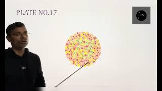 Color Vision Testing using Ishihara Chart by Dr Amit Tak, MD