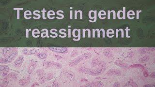 Changes Seen in Testes in Gender Reassignment - Pathology mini tutorial