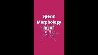 Sperm morphology refers to the size, shape, & appearance of a man's sperm #youtubevideos #ivfclinic