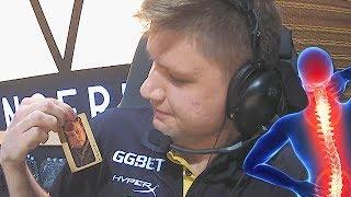 s1mple back pains...