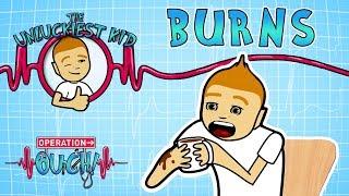 Science for kids - Bad Burns | Experiments for kids | Operation Ouch