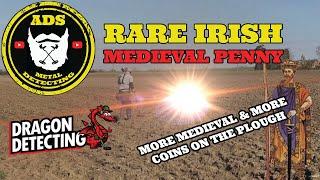 More Medieval Silver - Metal Detecting 2025 - Real Metal Detecting