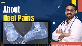 Heel Pains..Calcaneal Spur..Dr Sai Chandra #drsaichandra .. Orthopaedic Surgeon In Hyderabad