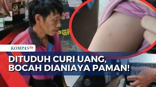 Tuduh Curi Uang, Paman Aniaya Keponakan yang Masih Berusia 10 Tahun!