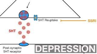 Major Depression and SSRI's/SNRI's