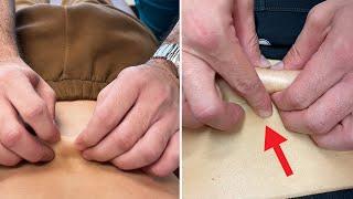 Skin Cav Pulling Cracks | Chiropractic treatment