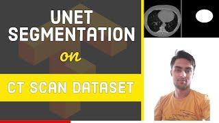 UNET Segmentation on CT Scan Images using TensorFlow 2.0 | Image Segmentation | Deep Learning