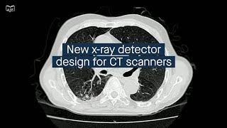 New x-ray detector design shows improved efficiency and versatility for computed tomography