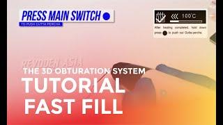 How To Use Fast fill 3D obturation System Eighteeth