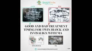 Using Panos for Twin Block and Invisalign MA Treatment Timing