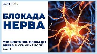 Блокада нерва.  УЗИ контроль блокады нерва в Клинике боли ЦЭЛТ.