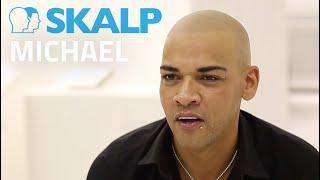 Michael tells how scalp micropigmentation changed his life. Watch his transformation at Skalp®