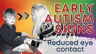 4 DIFFERENT Reasons Young Children May Have 'Poor' Eye Contact! Early Autism Signs Explained.