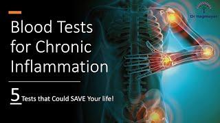 Best Tests for Chronic Inflammation- 5 Tests That Could Save Your Life