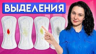 Выделения из влагалища. Такие выделения НЕ НОРМА!