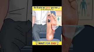 पैर में कांच का टुकड़ा चुभ गया। 3d animation treatment। #shorts #viral #animation #trending #asmr