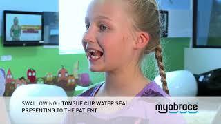 G3 Swallowing   Tongue Cup Water Seal